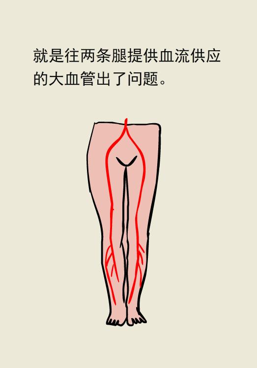 走着走着腿站不起来了是怎么回事,为什么走着走着腿就不累了