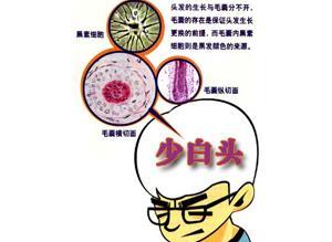 少白头自愈经历,少白头如何治疗