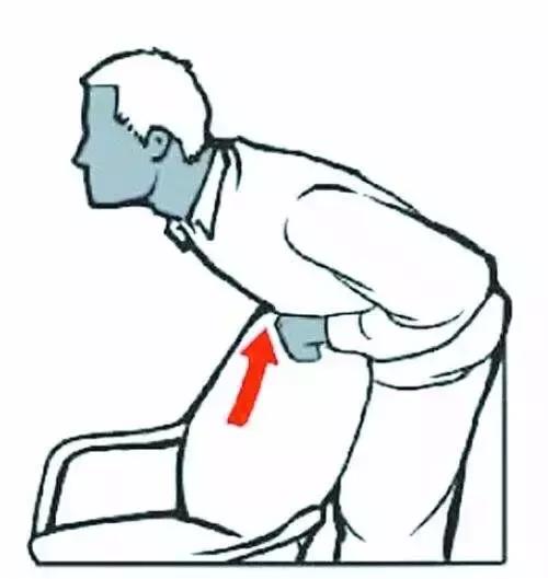 噎住急救法海姆立克单人,噎食的紧急救护方法海姆立克法