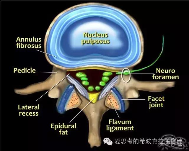 腰痛反射性腰痛,肾虚腰痛腰痛宁