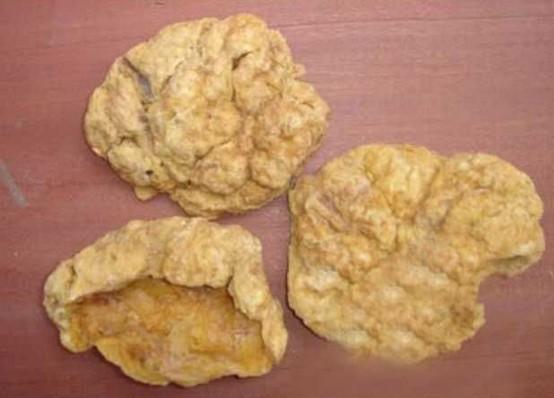 生完孩子胎盘怎么处理好,大家生完宝宝胎盘都怎么处理了