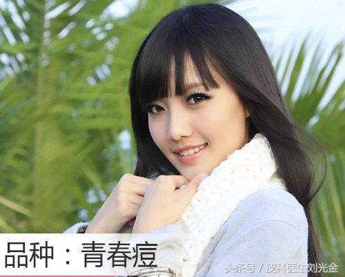 下巴长青春痘什么原因,长青春痘是什么原因怎么治疗