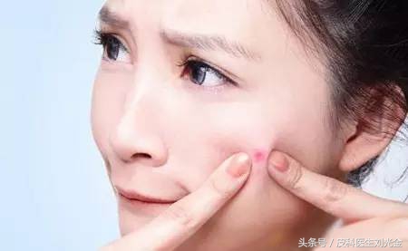 目前治疗痘痘的最佳方法,治疗痘痘最有效的医美方法