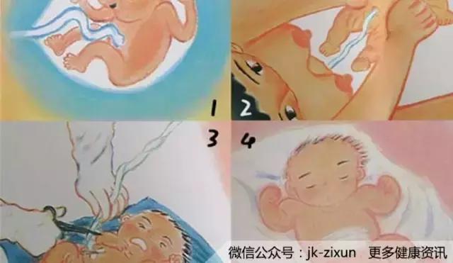 肚脐眼真的可以随便抠吗,肚脐眼你到底该不该抠