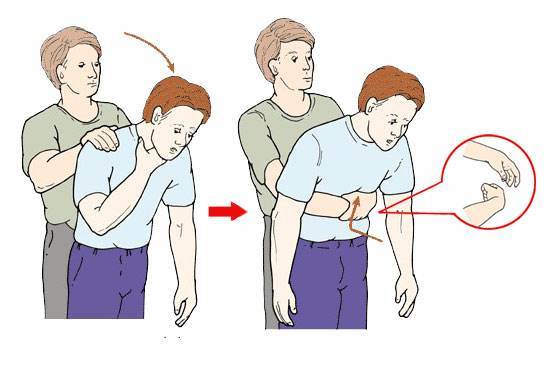 杭州84岁老太太吃汤圆险送命，关键时刻这招能救命！