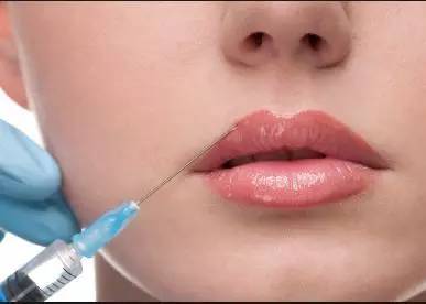 唇纹深怎么去除医美,去除唇纹小妙招不用唇膏