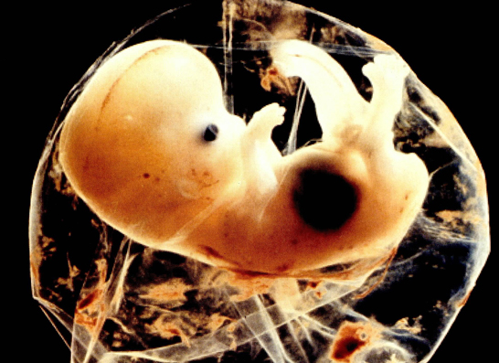 怎么辨别母猪羊水已破图片,怎么辨别羊水破了