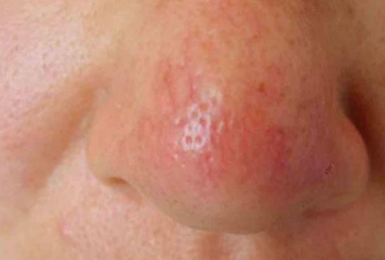 抽烟喝酒不良习惯,抽烟喝酒吃辣椒都是坏习惯