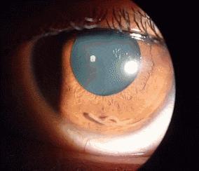 生肉去除寄生虫最好的办法,长期吃生肉18条寄生虫