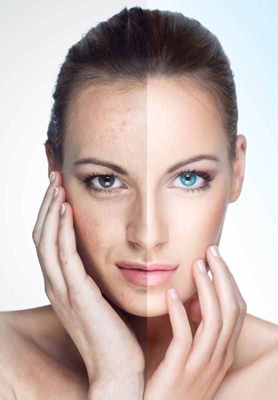 花了那么多钱，你的皮肤有好过吗？