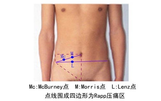 败酱草可以治疗肠痈吗,败酱草可以治疗所有肠胃疾病吗