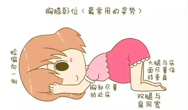 胎位不正散步有利于转正胎位吗,胎位不正医生手动转正胎位