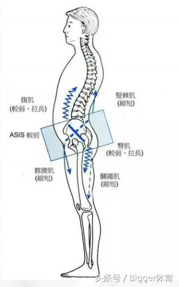 骨盆倾斜长短腿跑步有什么危害,骨盆倾斜对健身的影响