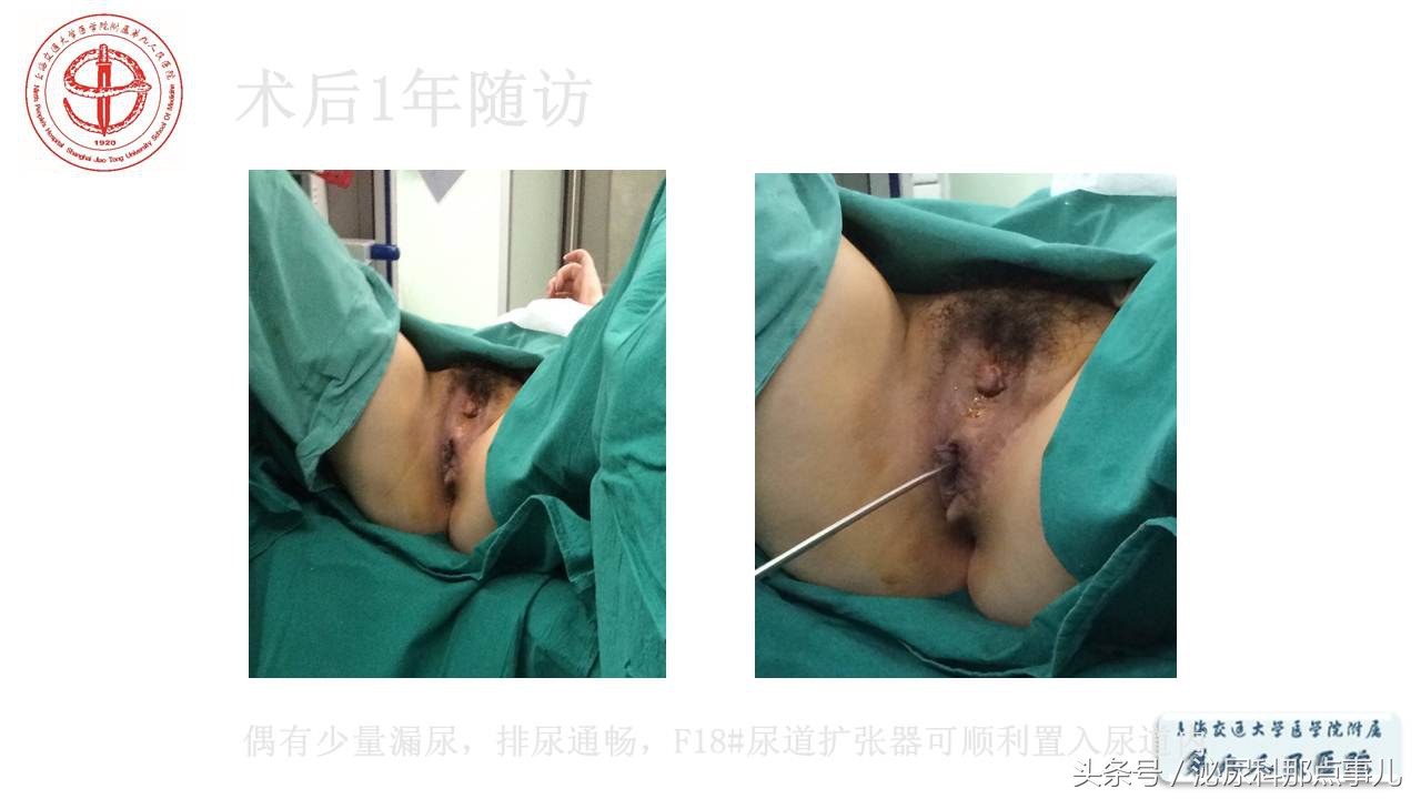 泌尿男科王忠教授,泌尿外科专家王忠教授