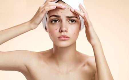 封闭型粉刺怎么弄才比较好？