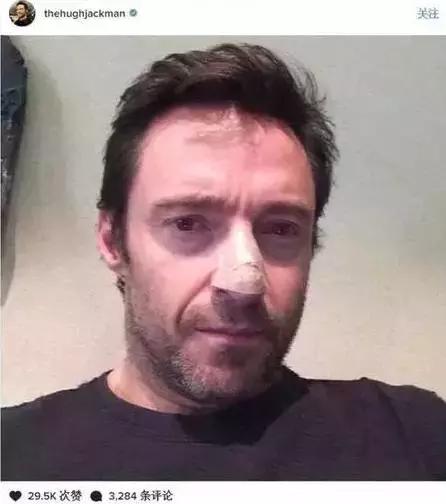 休杰克曼还会不会演金刚狼了 (休杰克曼牵手爱妻现身)