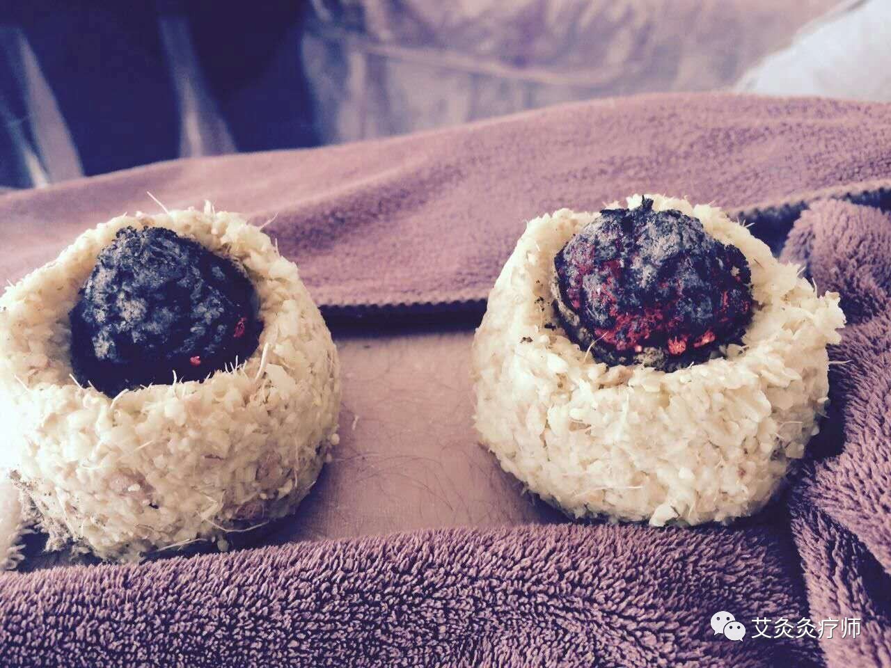 艾灸经络塑形,艾灸哪个穴位可以减内脏脂肪