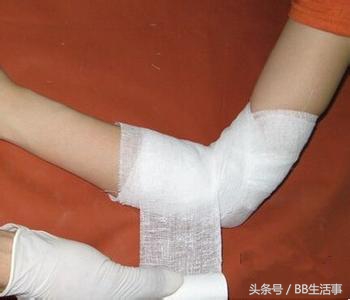 皮肤烫伤怎么办5步教你如何急救,宝宝烫伤后正确的急救措施