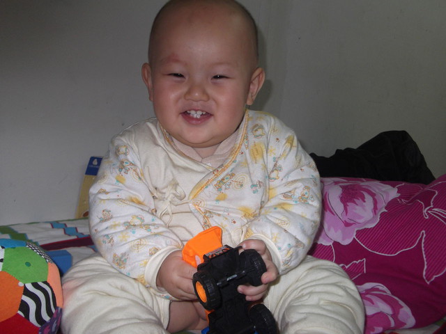 六个月宝宝感染水痘,六个月宝宝出水痘发烧了怎么办