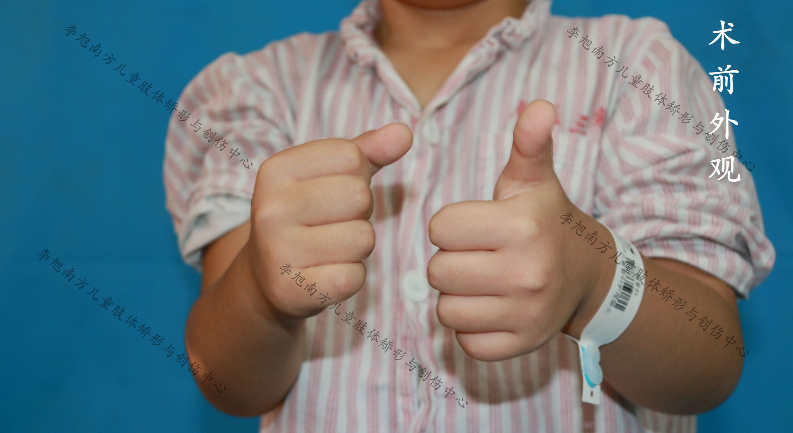 孩子胳膊摔伤后伸不直怎么办,小孩摔了跤胳膊伸不直是怎么回事