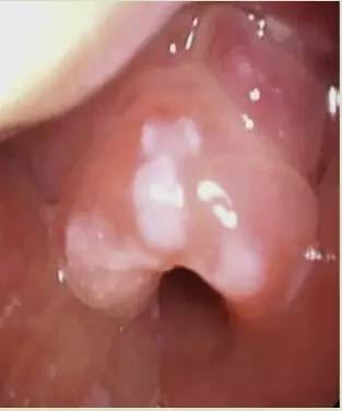 提醒不要疏忽大意的警示语,提醒不要疏忽大意的古句