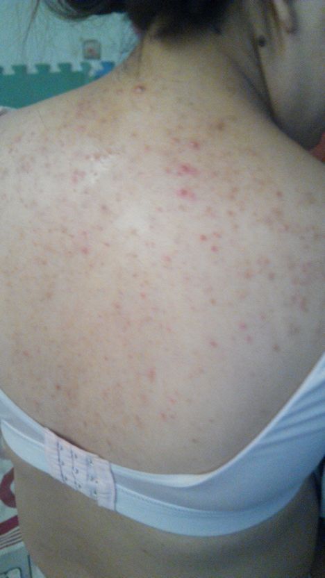 女性出现什么症状需要警惕,女性身体出现这些异样表现