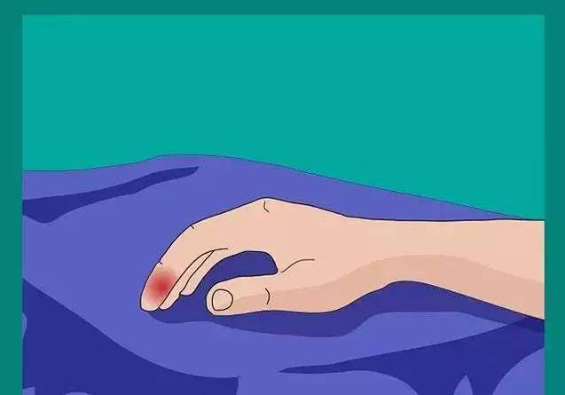 连这种痛都没经历过，都不好意思说你打过球！高手的必修绝技！