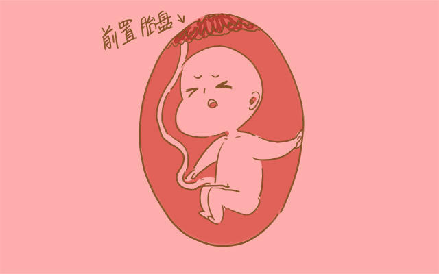 孕晚期胎盘有异常,前置胎盘孕晚期会导致流血吗