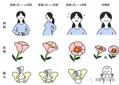 分娩最好的方法,顺产怎么分娩最快最有效