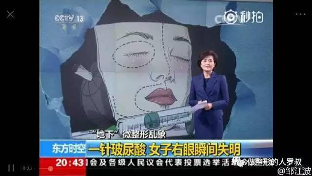 罗叔：10问玻尿酸（建议收藏）