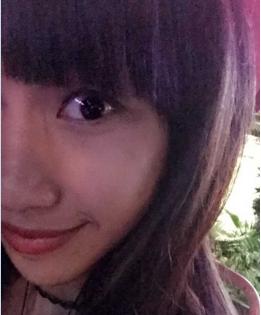 双眼皮割得太宽了怎么办,眼骨低割不了太宽的双眼皮