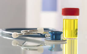 尿常规会查出大病吗,三分钟读懂尿常规