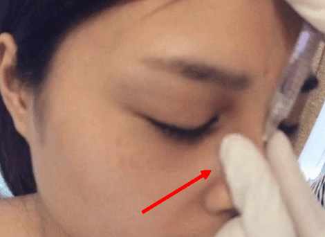 鐜诲翱閰稿埌搴曡兘涓嶈兘澶氭墦,鎵撶幓灏块吀鍒板簳鏈夊鐥涜嫤