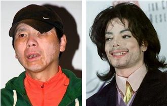 他肤色变白却饱受争议！