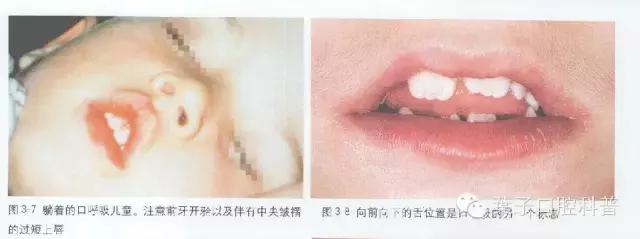 是谁将孩子推入网络深渊,是谁把宝宝推下了台阶