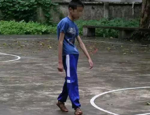 八字脚跑步对身体有什么影响,跑步怎么纠正外八字脚