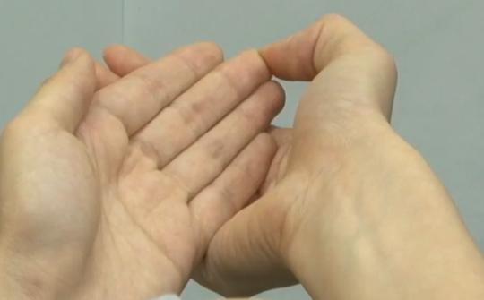 长针眼了怎么热敷,容易长针眼怎么调理