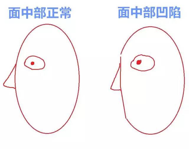 美女与野兽|天生法令纹只能靠整容吗?那是因为你没看这篇!