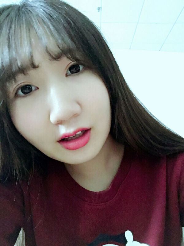 双眼皮全切手术恢复期,全切双眼皮恢复期眼尾分叉正常吗