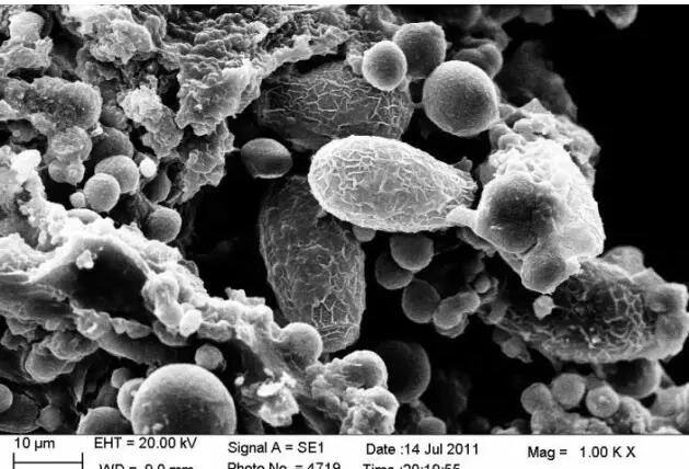一医院设立胆结石博物馆,胆结石博物馆