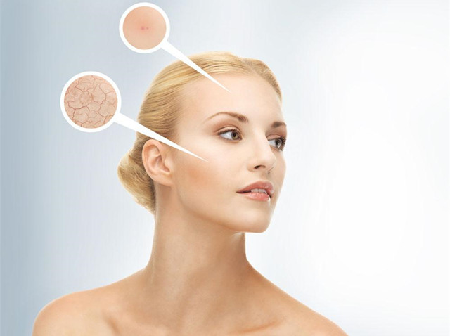 肌肤耐渴症是什么,什么是肌肤之渴