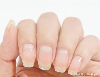 怎样判断体内有湿气的表现,怎样判断体内有湿气