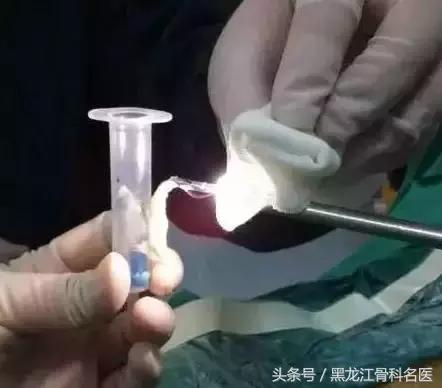 病例分享丨微创疗法让老人远离“腰突”困扰