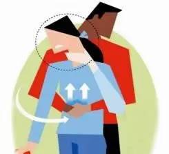 异物卡喉急救中医会怎么救,异物卡喉海姆立克急救法