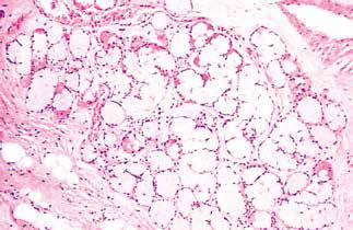 内镜做病理分析大概多久,作为一个医生太感性怎么办