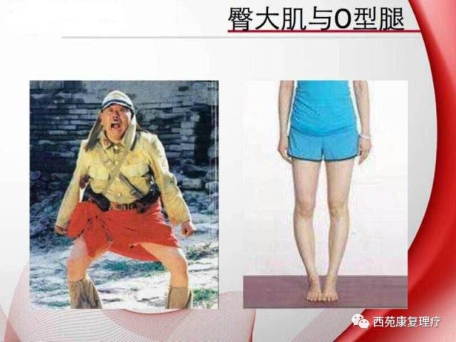 西苑康复理疗,西苑康复医院