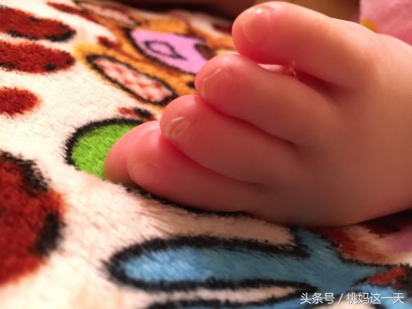 一岁宝宝剪指甲变黄,宝宝指甲黄色怎么回事