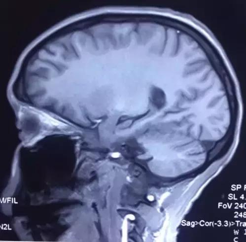 奇迹！跨越600公里疾速异地协作百草枯中毒患者起死回生