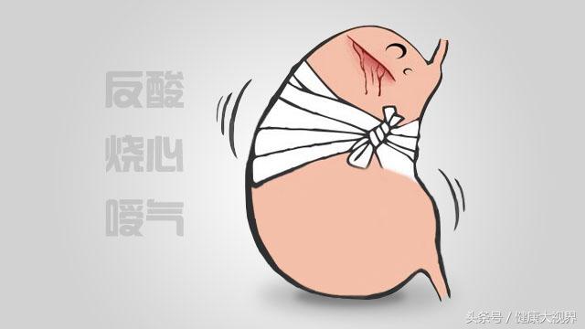 胆汁反流胃炎治疗方法患者讲述,胆汁反流性胃炎治愈方法药方