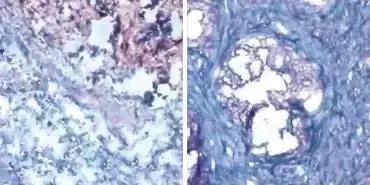 如何激活免疫系统对抗癌细胞,science治癌症